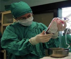 Trasplantes exitosos de células madre en el hospital villaclareño Arnaldo Milián Castro.
